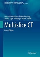 Multislice CT