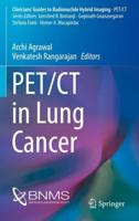 PET/CT in Lung Cancer. PET/CT