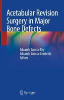 Acetabular Revision Surgery in Major Bone Defects