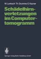 Schadelhirnverletzungen Im Computertomogramm