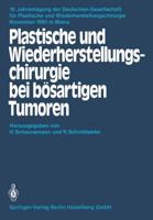 Plastische Und Wiederherstellungschirurgie Bei Bösartigen Tumoren