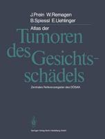 Atlas der Tumoren des Gesichtsschadels