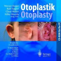 Otoplastik/Otoplasty
