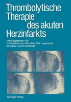 Thrombolytische Therapie des akuten Herzinfarkts