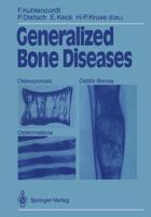 Generalized Bone Diseases : Osteoporosis Osteomalacia Ostitis fibrosa
