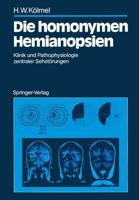 Die Homonymen Hemianopsien