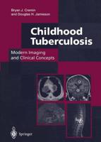 Childhood Tuberculosis