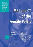 MRI and CT of the Female Pelvis. Diagnostic Imaging