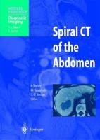 Spiral CT of the Abdomen. Diagnostic Imaging