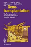 Xenotransplantation