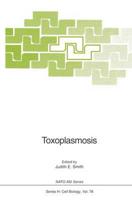 Toxoplasmosis