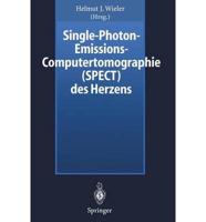 Single-Photon-Emissions-Computertomographie (SPECT) des Herzens