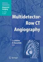 Multidetector-Row CT Angiography. Diagnostic Imaging