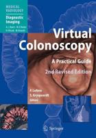 Virtual Colonoscopy