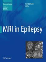 MRI in Epilepsy. Diagnostic Imaging