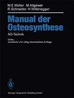 Manual der OSTEOSYNTHESE : AO-Technik