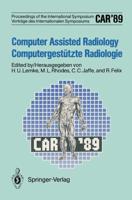 Car'89 Computer Assisted Radiology / Computergestutzte Radiologie: Proceedings of the 3rd International Symposium / Vortrage Des 3. Internationalen Sy