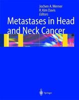 Metastases in Head and Neck Cancer