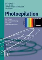 Photoepilation