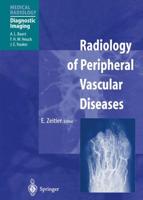 Radiology of Peripheral Vascular Diseases. Diagnostic Imaging