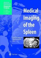 Medical Imaging of the Spleen. Diagnostic Imaging