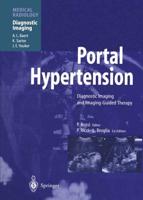 Portal Hypertension Diagnostic Imaging