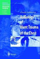 Radiology of Blunt Trauma of the Chest. Diagnostic Imaging