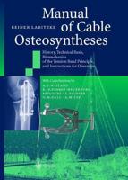 Manual of Cable Osteosyntheses : History, Technical Basis, Biomechanics of the Tension Band Principle, and Instructions for Operation