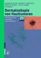 Dermatoskopie von Hauttumoren : Auflichtmikroskopie - Dermoskopie - Digitale Bildanalyse