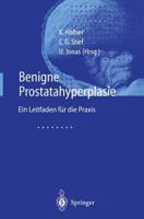 Benigne Prostatahyperplasie : Leitfaden für die Praxis