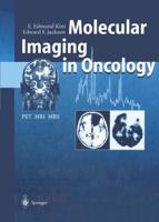 Molecular Imaging in Oncology