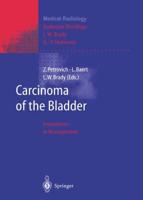 Carcinoma of the Bladder Radiation Oncology