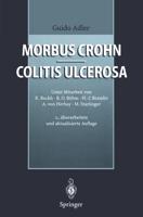 Morbus Crohn - Colitis ulcerosa