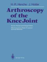 Arthroscopy of the Knee Joint : Diagnosis and Operation Techniques