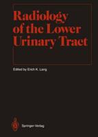 Radiology of the Lower Urinary Tract. Diagnostic Imaging