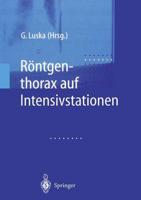 Rontgenthorax auf Intensivstationen