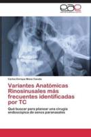 Variantes Anatómicas Rinosinusales más frecuentes identificadas por TC