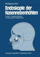 Endoskopie Der Nasennebenhohlen: Technik . Typische Befunde, Therapeutische Moglichkeiten