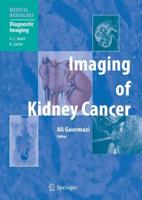 Imaging of Kidney Cancer. Diagnostic Imaging