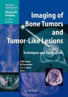 Imaging of Bone Tumors and Tumor-Like Lesions : Techniques and Applications