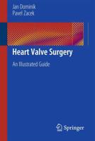 Heart Valve Surgery : An Illustrated Guide