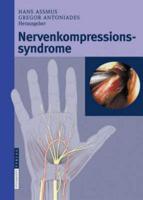 Nervenkompressionssyndrome