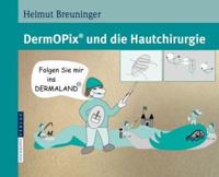 DermOPix¬ Und Die Hautchirurgie