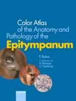 Color Atlas of the Anatomy and Pathology of the Epitympanum