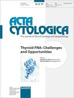 Thyroid FNA: Challenges and Opportunities