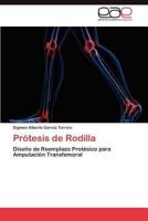 Protesis de Rodilla