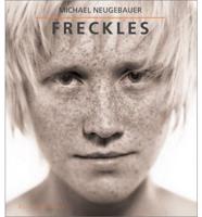 Freckles