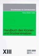 Handbuch des Kronen- und Brückenersatzes