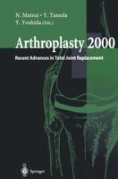 Arthroplasty 2000 : Recent Advances in Total Joint Replacement