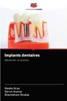 Implants Dentaires